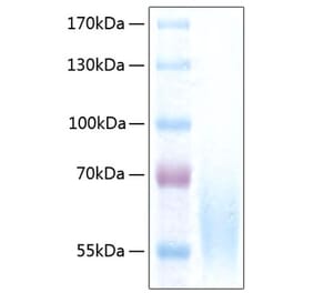 SDS-PAGE - Recombinant Human CEACAM1 Protein (C-terminal His Tag) (A330442) - Antibodies.com