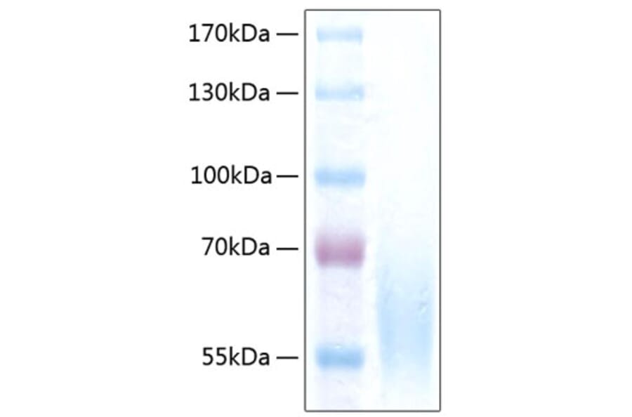 SDS-PAGE - Recombinant Human CEACAM1 Protein (C-terminal His Tag) (A330442) - Antibodies.com