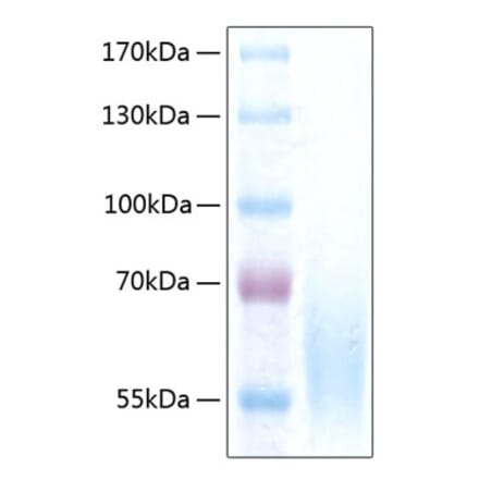 SDS-PAGE - Recombinant Human CEACAM1 Protein (C-terminal His Tag) (A330442) - Antibodies.com