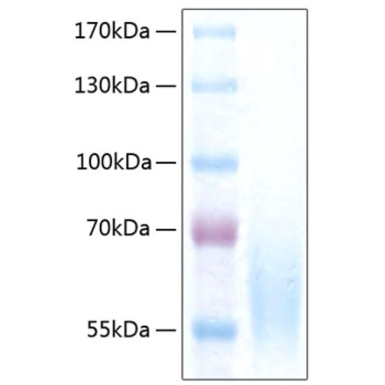 SDS-PAGE - Recombinant Human CEACAM1 Protein (C-terminal His Tag) (A330442) - Antibodies.com