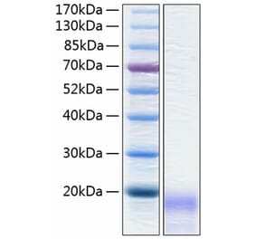 SDS-PAGE - Recombinant Human CEACAM3 Protein (C-terminal His Tag) (A330443) - Antibodies.com
