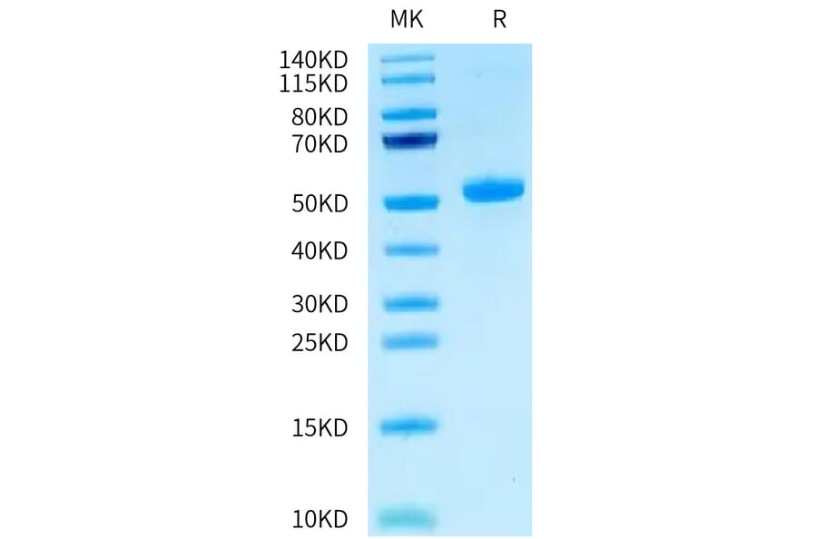 Tris-Bis PAGE - Recombinant Human CEACAM3 Protein (C-terminal Human Fc Tag) (A330444) - Antibodies.com