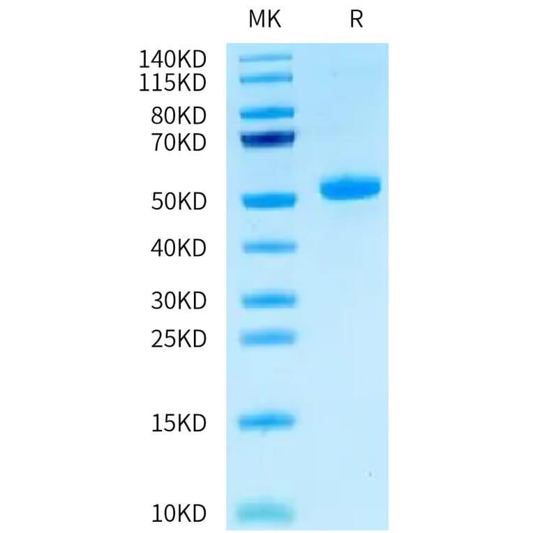 Tris-Bis PAGE - Recombinant Human CEACAM3 Protein (C-terminal Human Fc Tag) (A330444) - Antibodies.com