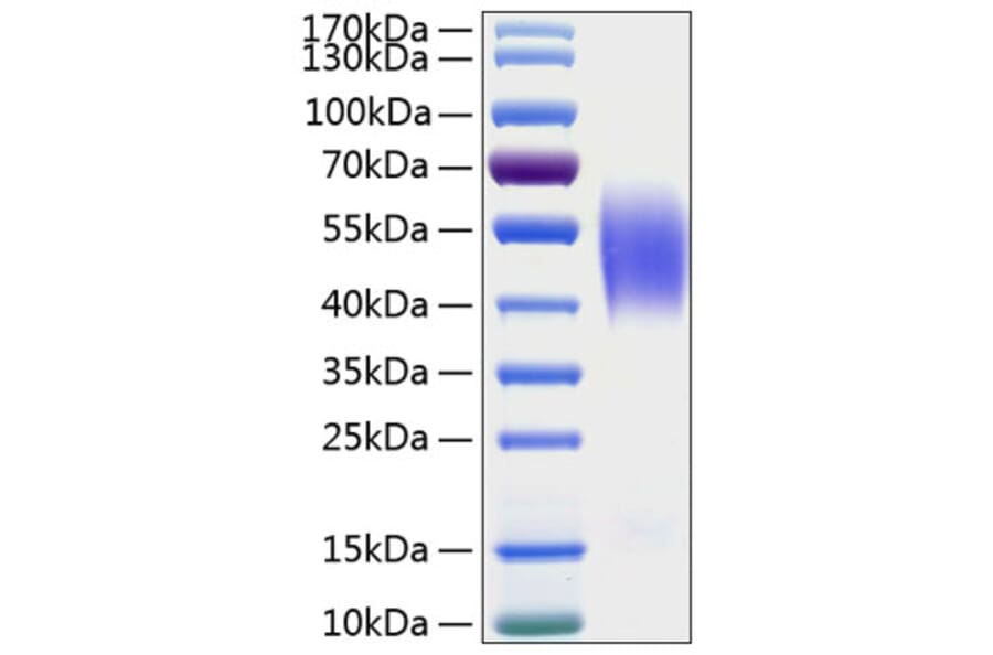 SDS-PAGE - Recombinant Human CEACAM6 Protein (C-terminal His Tag) (A330445) - Antibodies.com