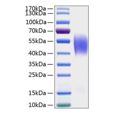 SDS-PAGE - Recombinant Human CEACAM6 Protein (C-terminal His Tag) (A330445) - Antibodies.com