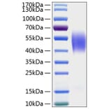 SDS-PAGE - Recombinant Human CEACAM6 Protein (C-terminal His Tag) (A330445) - Antibodies.com