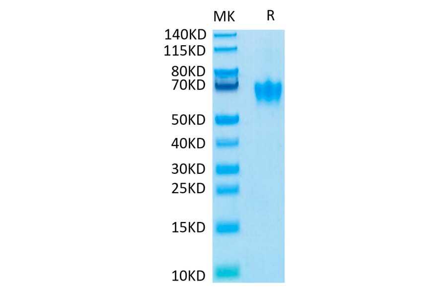 Tris-Bis PAGE - Recombinant Human CEACAM6 Protein (Biotin) (C-terminal His and Avi Tag) (A330446) - Antibodies.com
