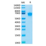 Tris-Bis PAGE - Recombinant Human CEACAM6 Protein (Biotin) (C-terminal His and Avi Tag) (A330446) - Antibodies.com