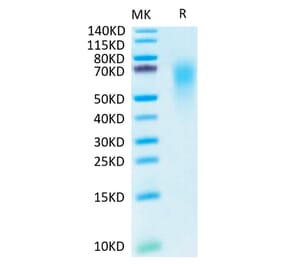 Tris-Bis PAGE - Recombinant Human CEACAM6 Protein (C-terminal His and Avi Tag) (A330447) - Antibodies.com
