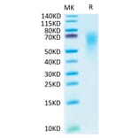 Tris-Bis PAGE - Recombinant Human CEACAM6 Protein (C-terminal His and Avi Tag) (A330447) - Antibodies.com