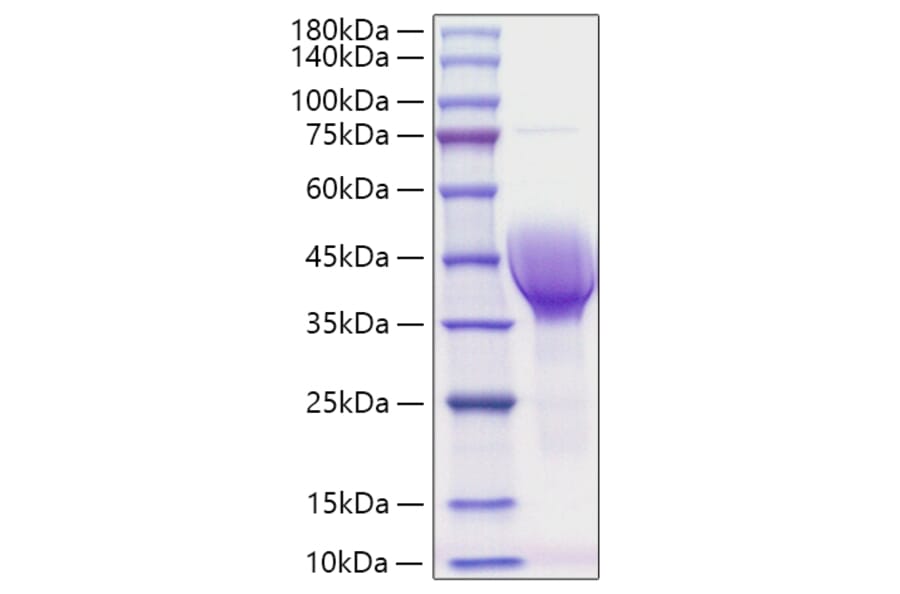 SDS-PAGE - Recombinant Human CER1 Protein (C-terminal His Tag) (A330448) - Antibodies.com