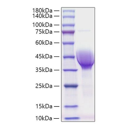 SDS-PAGE - Recombinant Human CER1 Protein (C-terminal His Tag) (A330448) - Antibodies.com