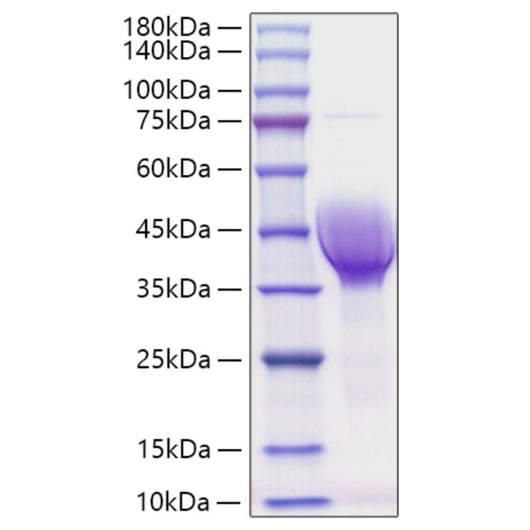 SDS-PAGE - Recombinant Human CER1 Protein (C-terminal His Tag) (A330448) - Antibodies.com