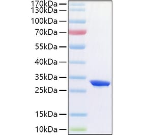 SDS-PAGE - Recombinant Human CFD Protein (C-terminal His Tag) (A330449) - Antibodies.com