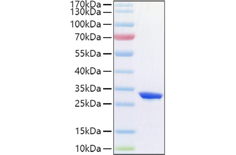 SDS-PAGE - Recombinant Human CFD Protein (C-terminal His Tag) (A330449) - Antibodies.com