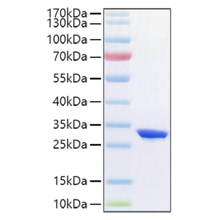 SDS-PAGE - Recombinant Human CFD Protein (C-terminal His Tag) (A330449) - Antibodies.com