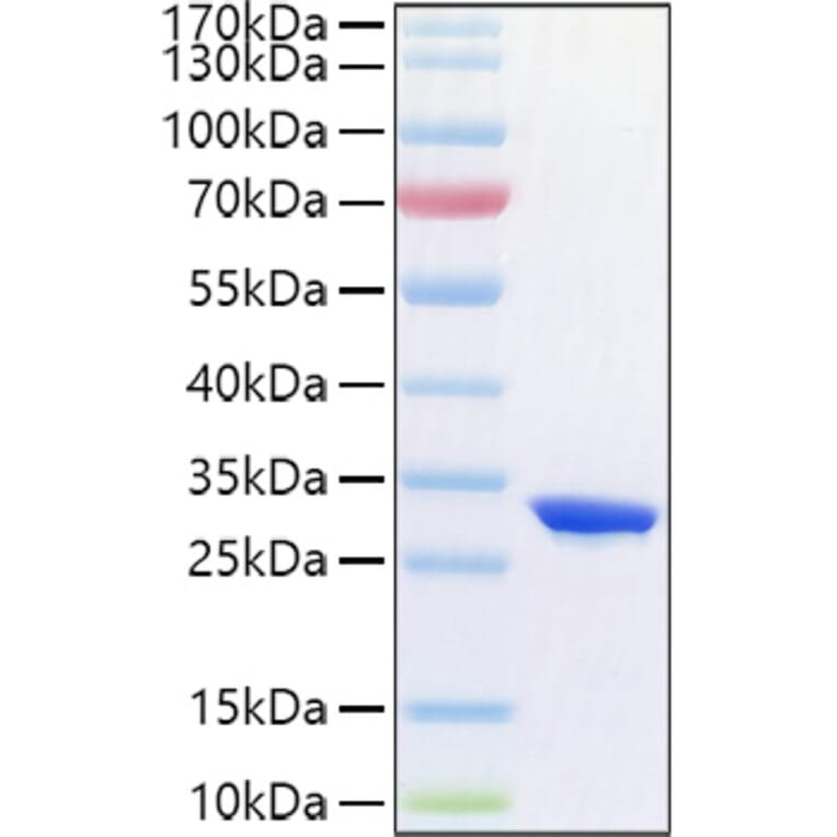 SDS-PAGE - Recombinant Human CFD Protein (C-terminal His Tag) (A330449) - Antibodies.com