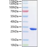 SDS-PAGE - Recombinant Human CFD Protein (C-terminal His Tag) (A330449) - Antibodies.com