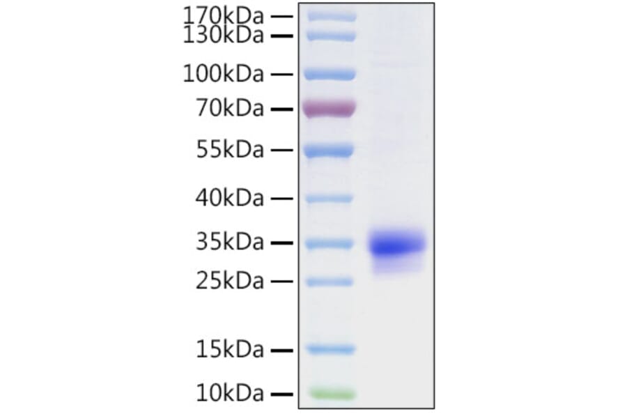 SDS-PAGE - Recombinant Human CFHL2 Protein (C-terminal His Tag) (A330450) - Antibodies.com