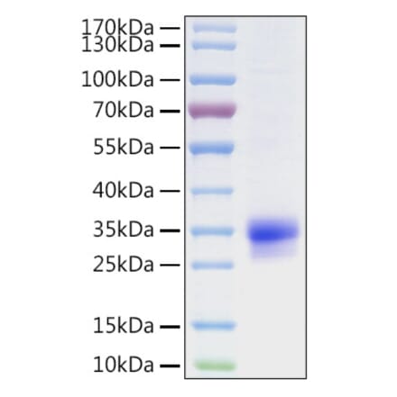 SDS-PAGE - Recombinant Human CFHL2 Protein (C-terminal His Tag) (A330450) - Antibodies.com