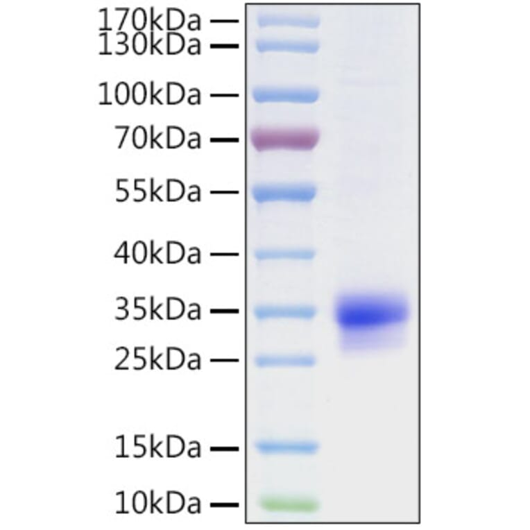 SDS-PAGE - Recombinant Human CFHL2 Protein (C-terminal His Tag) (A330450) - Antibodies.com