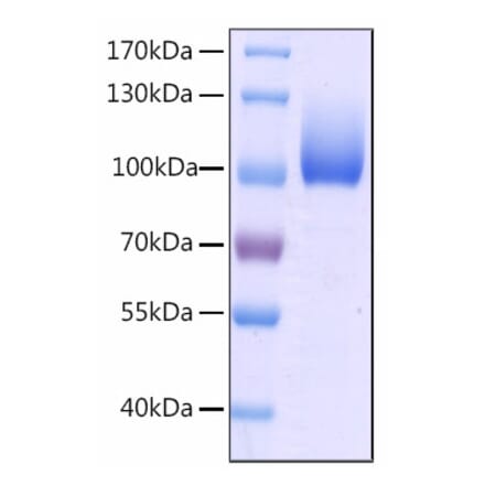 SDS-PAGE - Recombinant Human CFHR4 Protein (C-terminal His Tag) (A330451) - Antibodies.com