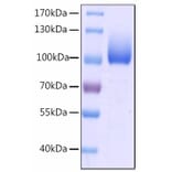 SDS-PAGE - Recombinant Human CFHR4 Protein (C-terminal His Tag) (A330451) - Antibodies.com