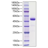 SDS-PAGE - Recombinant Human Chemerin Protein (C-terminal Human Fc Tag) (A330452) - Antibodies.com