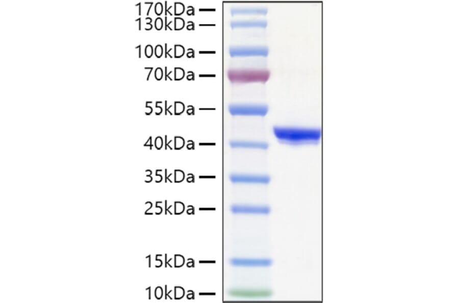 SDS-PAGE - Recombinant Human CHI3L1 Protein (C-terminal His Tag) (A330453) - Antibodies.com