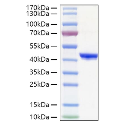 SDS-PAGE - Recombinant Human CHI3L1 Protein (C-terminal His Tag) (A330453) - Antibodies.com