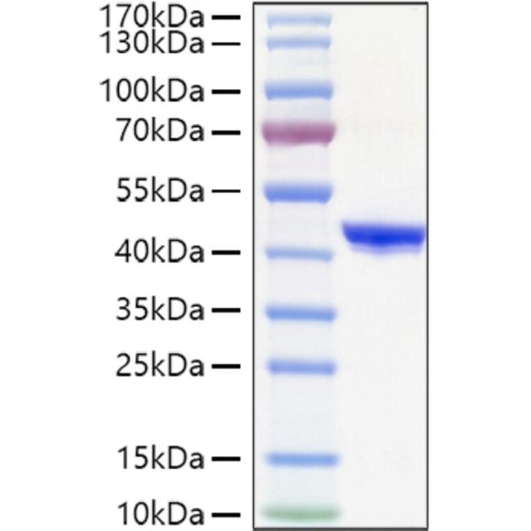 SDS-PAGE - Recombinant Human CHI3L1 Protein (C-terminal His Tag) (A330453) - Antibodies.com