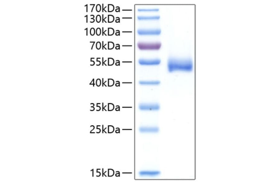 SDS-PAGE - Recombinant Human CHIT1 Protein (C-terminal His Tag) (A330454) - Antibodies.com