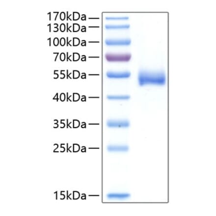 SDS-PAGE - Recombinant Human CHIT1 Protein (C-terminal His Tag) (A330454) - Antibodies.com