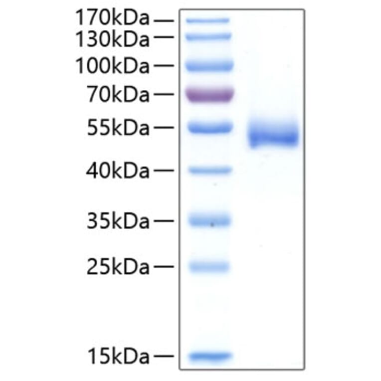 SDS-PAGE - Recombinant Human CHIT1 Protein (C-terminal His Tag) (A330454) - Antibodies.com