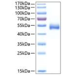SDS-PAGE - Recombinant Human CHIT1 Protein (C-terminal His Tag) (A330454) - Antibodies.com