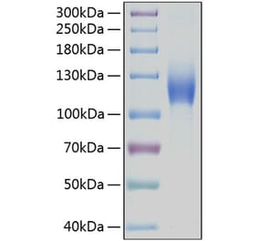 SDS-PAGE - Recombinant Human c-Kit Protein (C-terminal Human Fc and His Tag) (A330455) - Antibodies.com