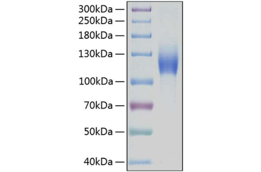 SDS-PAGE - Recombinant Human c-Kit Protein (C-terminal Human Fc and His Tag) (A330455) - Antibodies.com