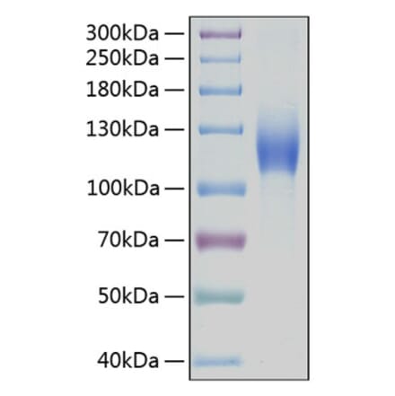 SDS-PAGE - Recombinant Human c-Kit Protein (C-terminal Human Fc and His Tag) (A330455) - Antibodies.com
