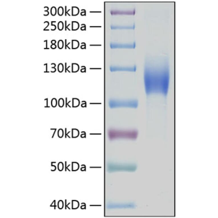 SDS-PAGE - Recombinant Human c-Kit Protein (C-terminal Human Fc and His Tag) (A330455) - Antibodies.com