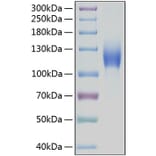 SDS-PAGE - Recombinant Human c-Kit Protein (C-terminal Human Fc and His Tag) (A330455) - Antibodies.com