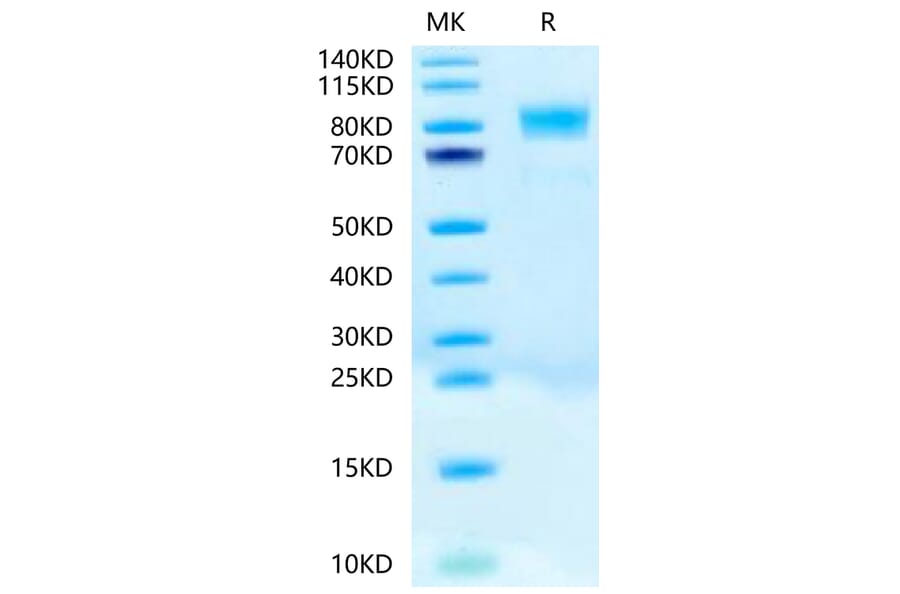 Tris-Bis PAGE - Recombinant Human c-Kit Protein (Biotin) (C-terminal His and Avi Tag) (A330456) - Antibodies.com