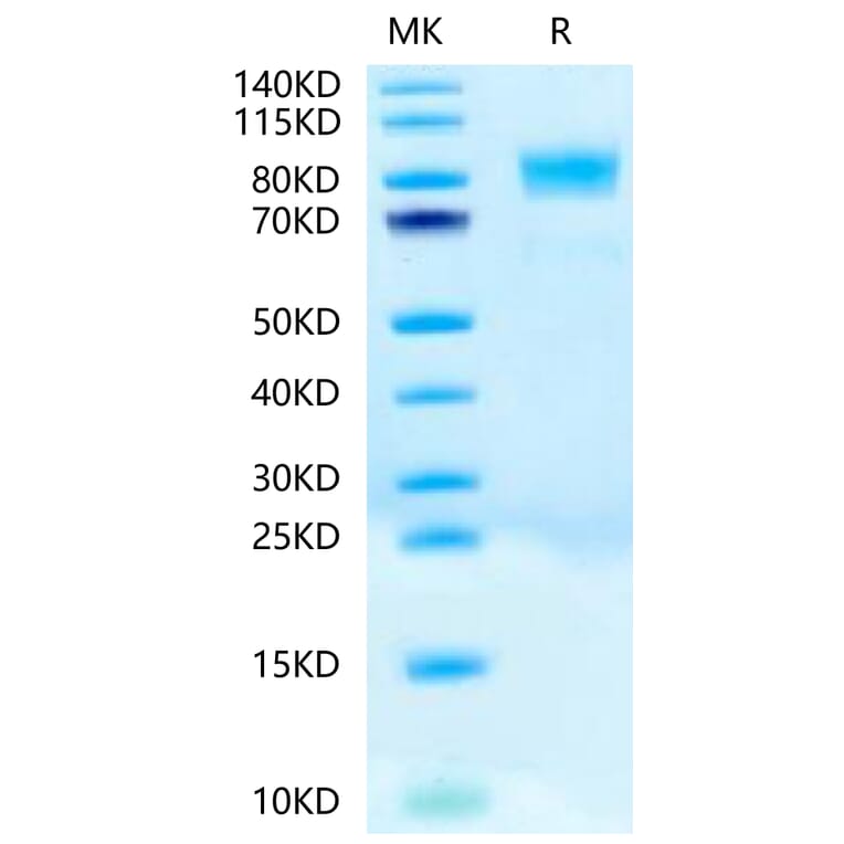 Tris-Bis PAGE - Recombinant Human c-Kit Protein (Biotin) (C-terminal His and Avi Tag) (A330456) - Antibodies.com