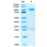 Tris-Bis PAGE - Recombinant Human c-Kit Protein (Biotin) (C-terminal His and Avi Tag) (A330456) - Antibodies.com