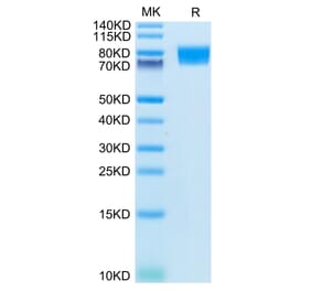 Tris-Bis PAGE - Recombinant Human c-Kit Protein (C-terminal His Tag) (A330457) - Antibodies.com