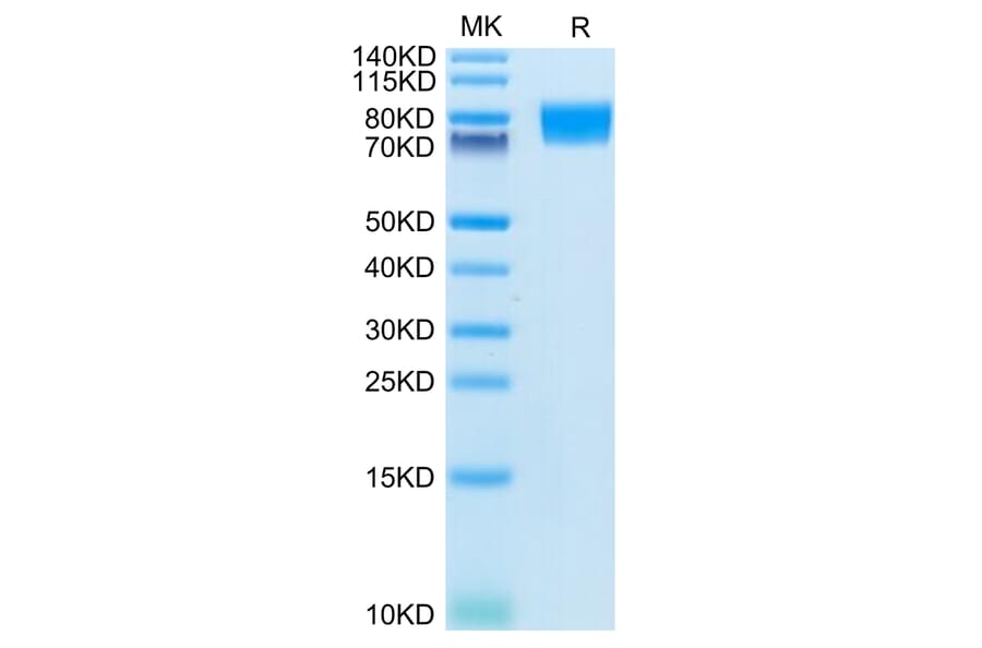 Tris-Bis PAGE - Recombinant Human c-Kit Protein (C-terminal His Tag) (A330457) - Antibodies.com