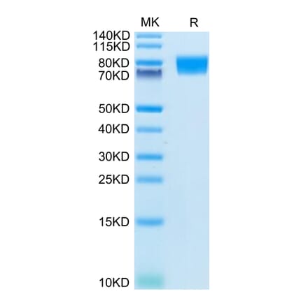 Tris-Bis PAGE - Recombinant Human c-Kit Protein (C-terminal His Tag) (A330457) - Antibodies.com