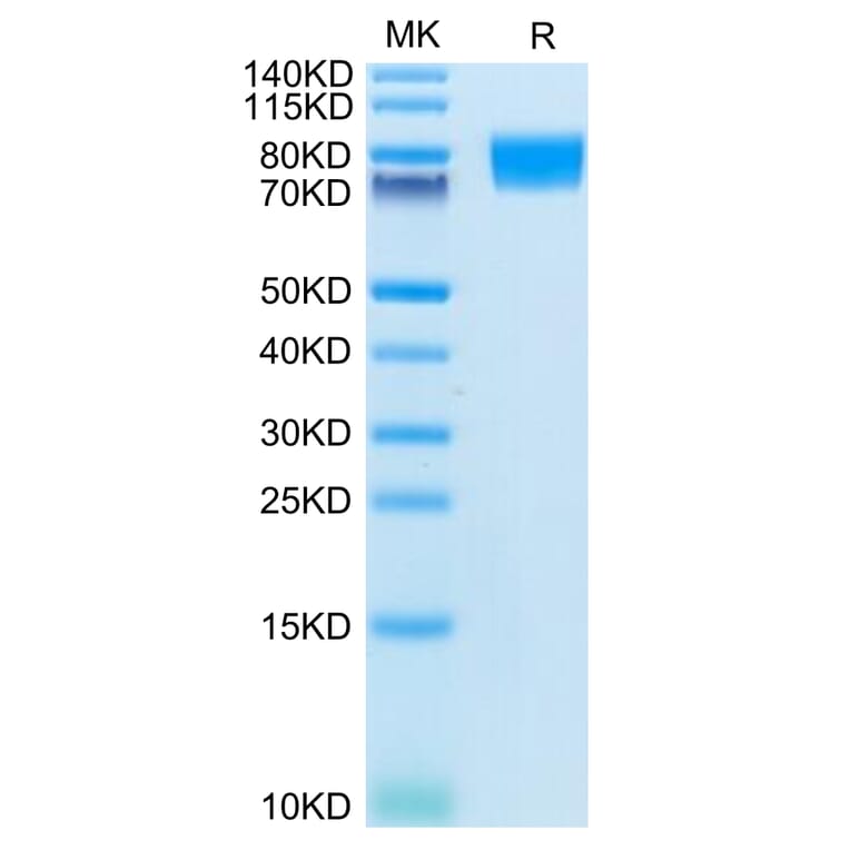 Tris-Bis PAGE - Recombinant Human c-Kit Protein (C-terminal His Tag) (A330457) - Antibodies.com