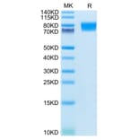 Tris-Bis PAGE - Recombinant Human c-Kit Protein (C-terminal His Tag) (A330457) - Antibodies.com