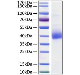 SDS-PAGE - Recombinant Human CLEC10A Protein (C-terminal His Tag) (A330458) - Antibodies.com