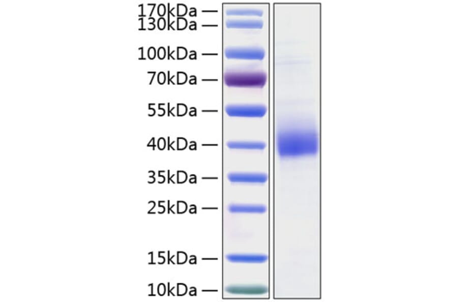 SDS-PAGE - Recombinant Human CLEC10A Protein (C-terminal His Tag) (A330458) - Antibodies.com
